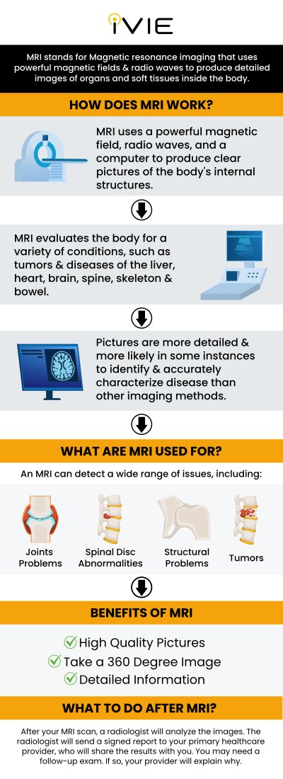 A medical imaging technology called magnetic resonance imaging is used in radiology to provide images of the body's physiology and anatomy. MRI scanners create images of the body's organs using powerful magnetic fields, magnetic field gradients, and radio waves. Meet Dr. Kourosh Naini at the iVIE MRI Screening Center if you are looking for an MRI Clinic. For more information, contact us or book an appointment online. We are located at 11600 Washington Pl Suite 104A, Culver City, CA 90066.